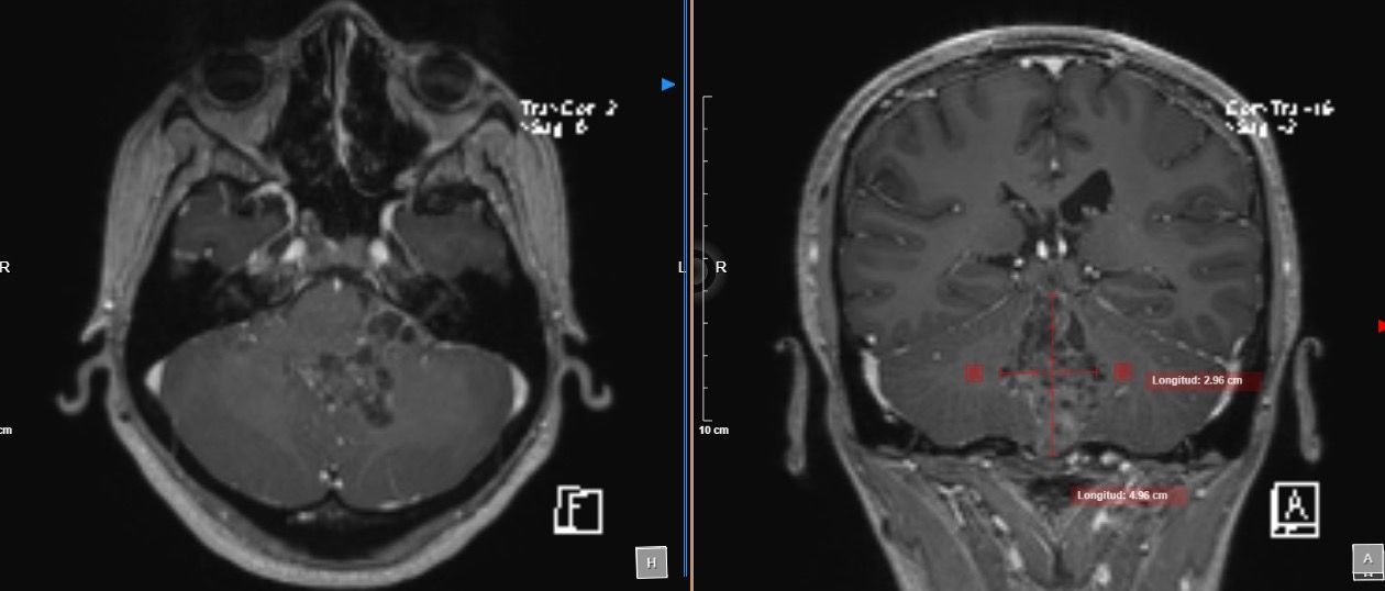 Marco Antonio Díaz Montoya-5