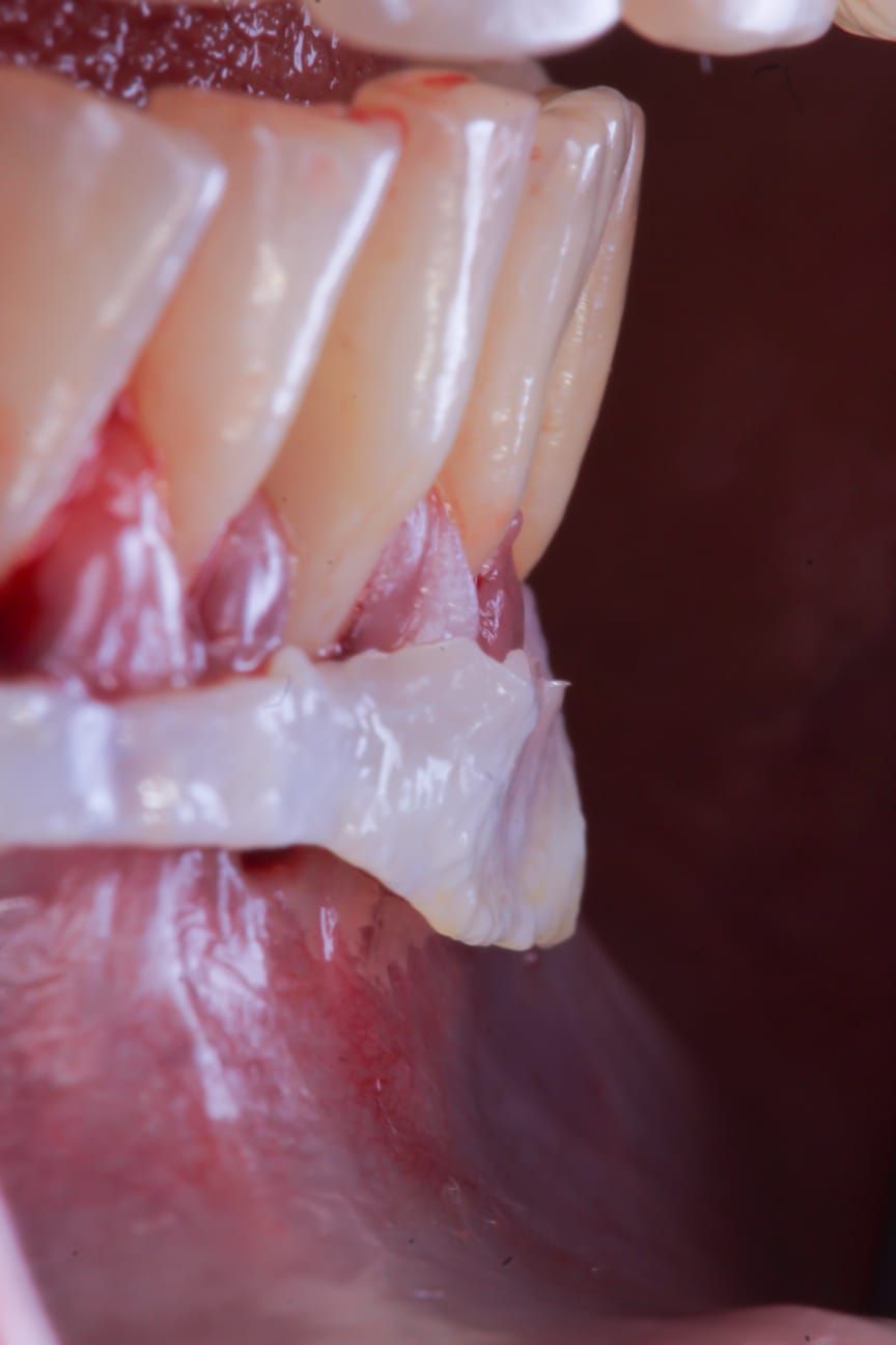 Hugo Enrique Aguilar Lamas-40