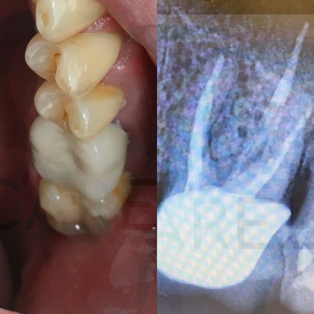 Carlos Candelaria Margarito-4