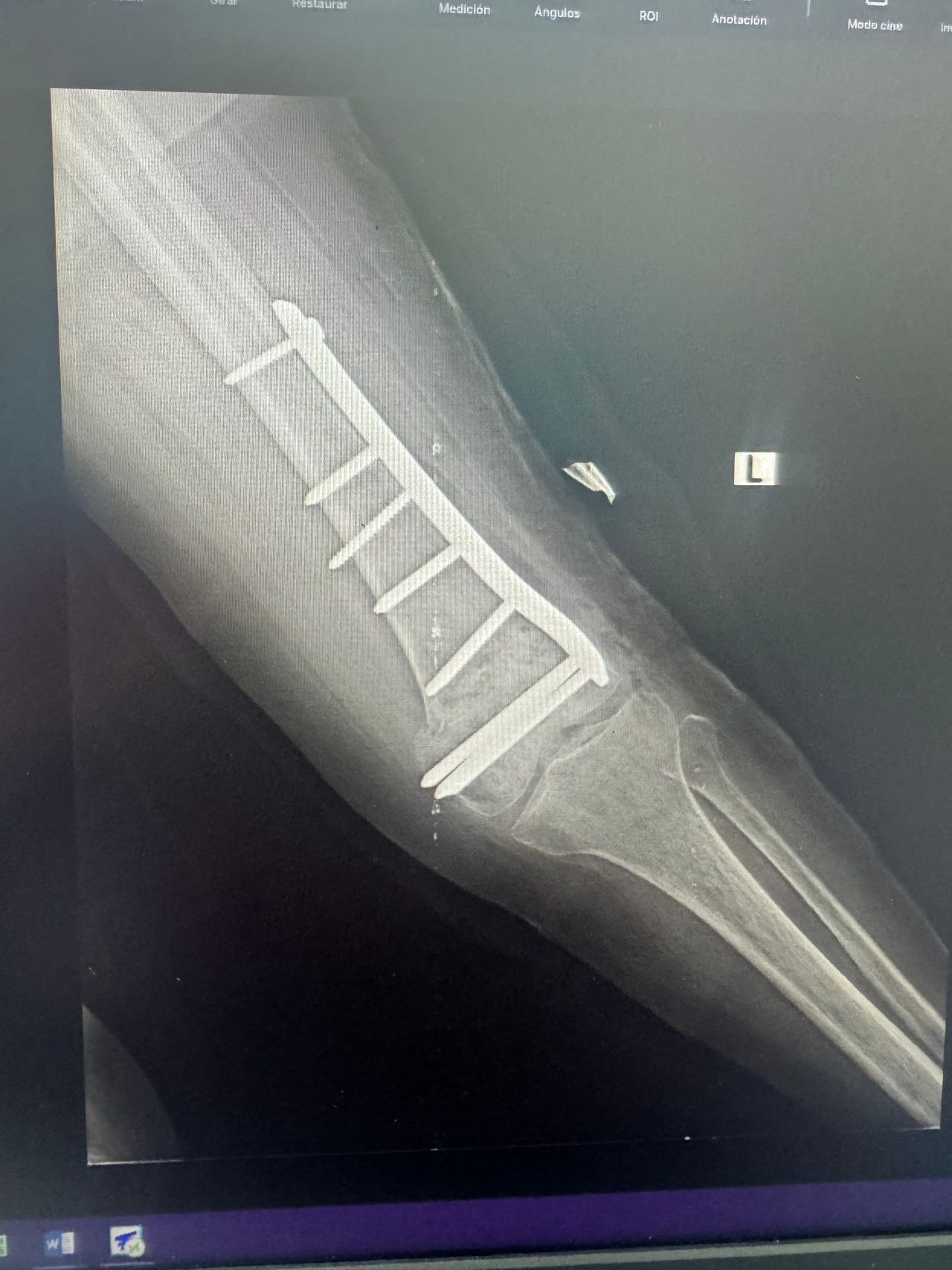 Carmen Yossaleth Briceño González-8