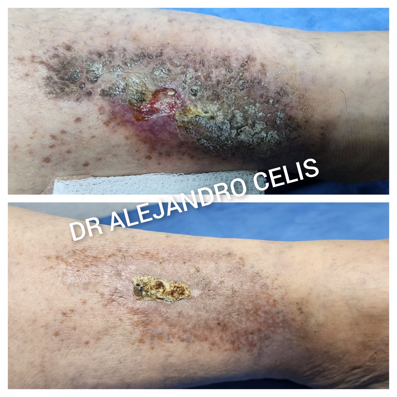 Alejandro Celis Jiménez-3