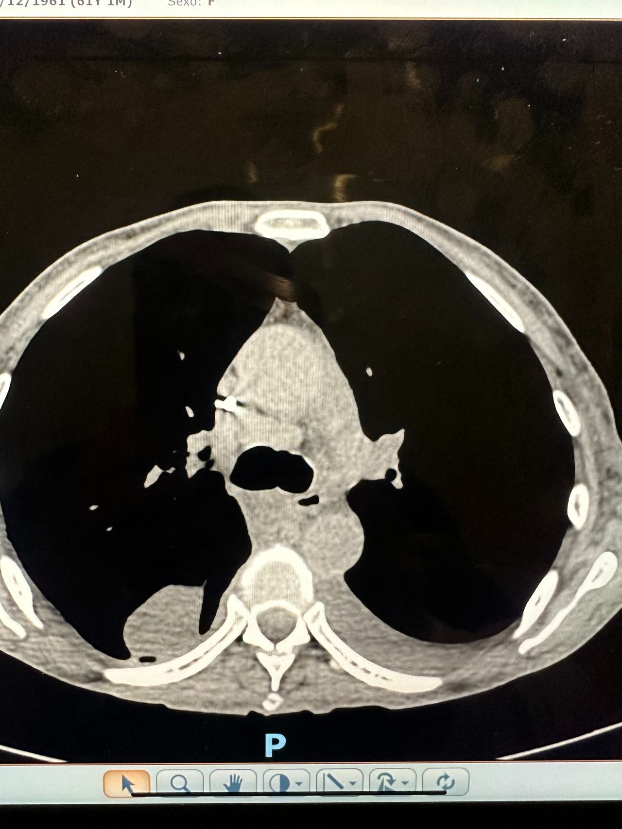 Jose Ivan Juarez Ramirez-3