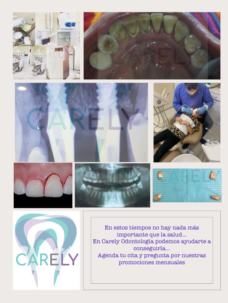 Carlos Candelaria Margarito-3