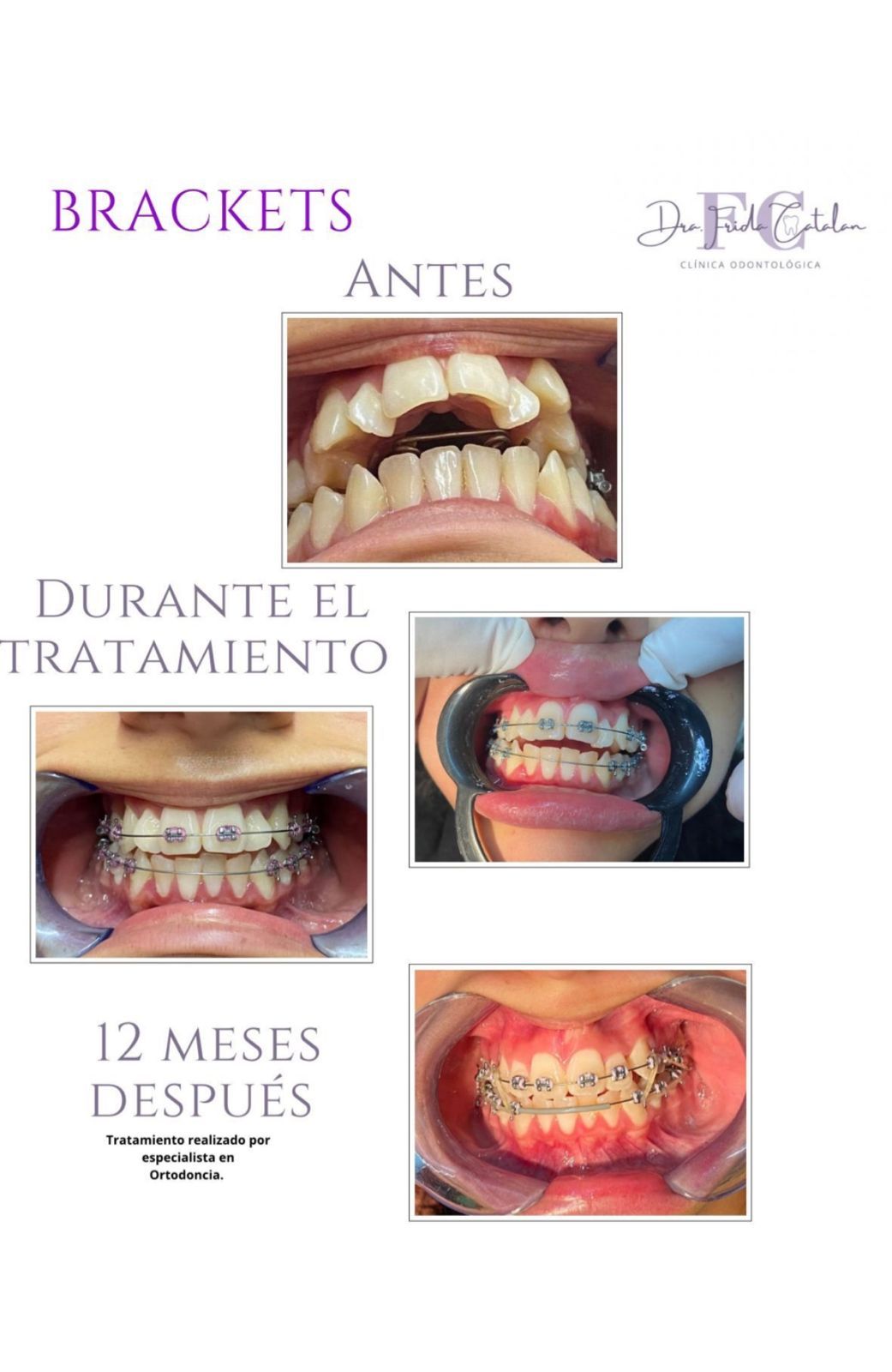 Frida Catalan Verdi-6