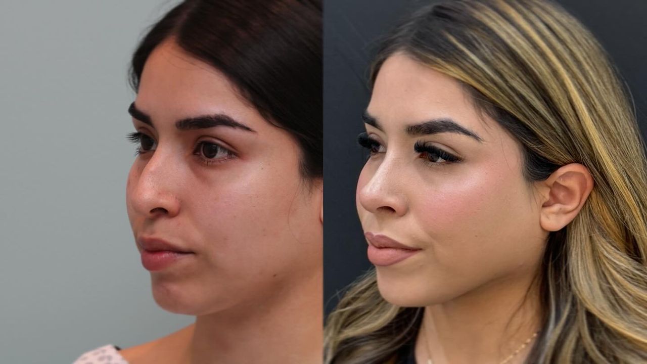 Angel Castro Urquizo-149