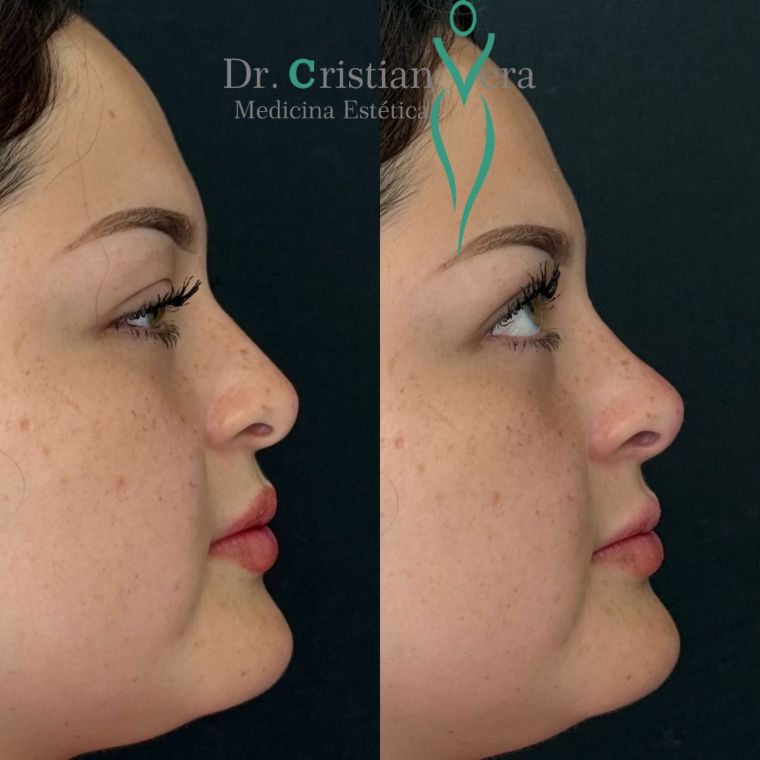 Cristian Eduardo Vera Nuño-8