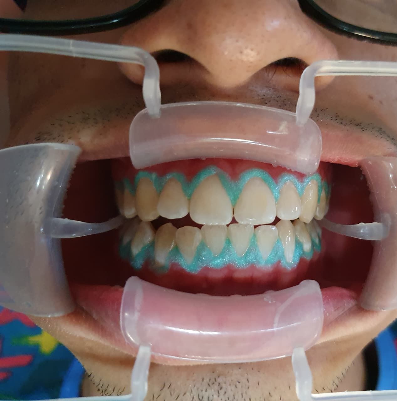 Fernando Olivier Victoriano-10