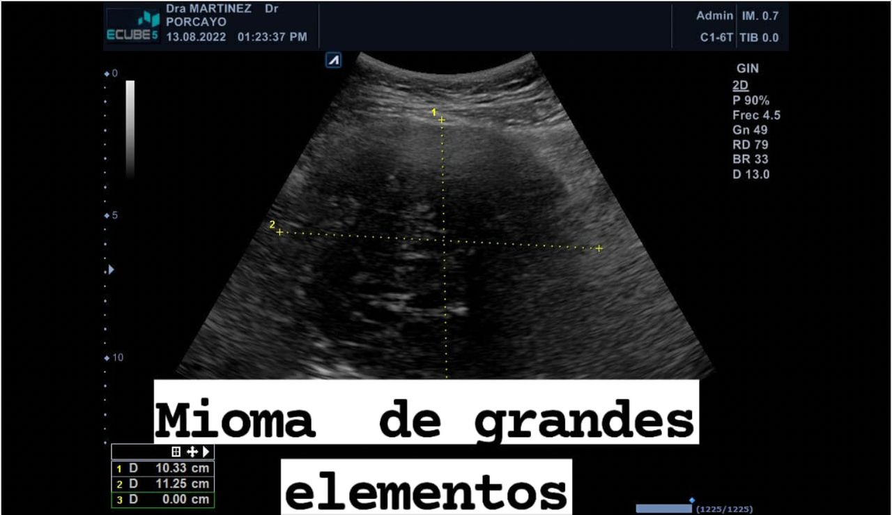 Joel Porcayo Garcia-14