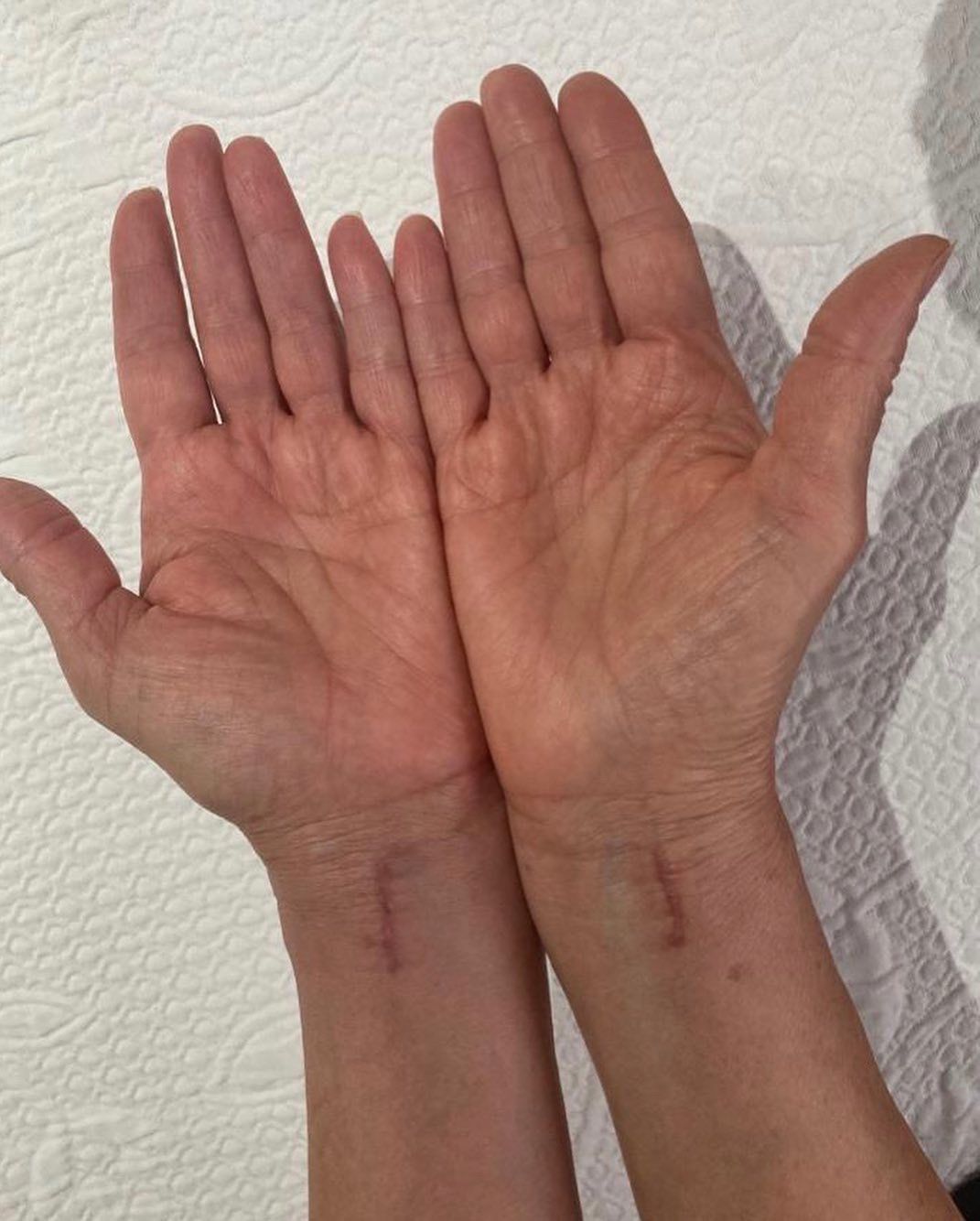 Jonatan Garcia  Garcia-15