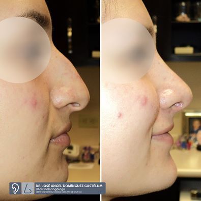 Jose Angel Dominguez Gastelum-7