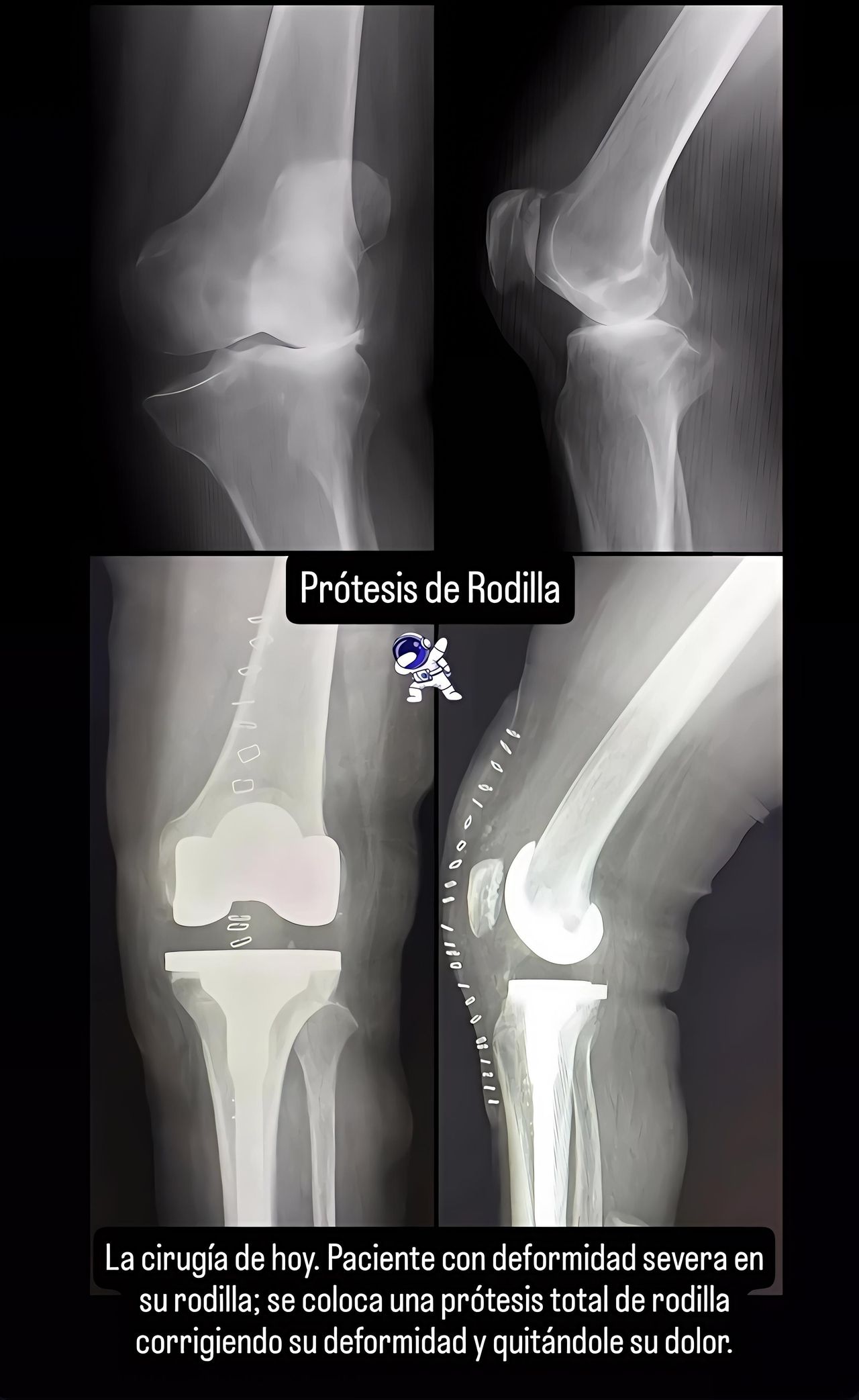 Noé Saavedra Islas-5