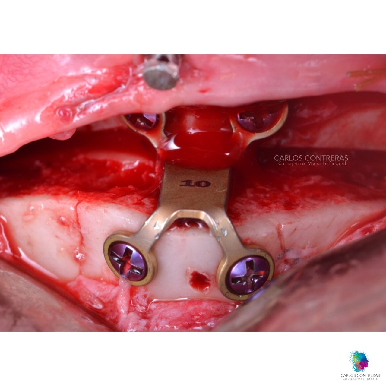 Carlos Ernesto Contreras Castellanos-43