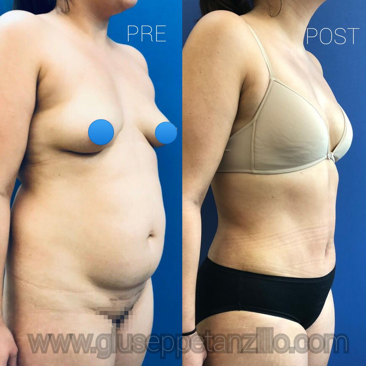 Giuseppe Tanzillo-36