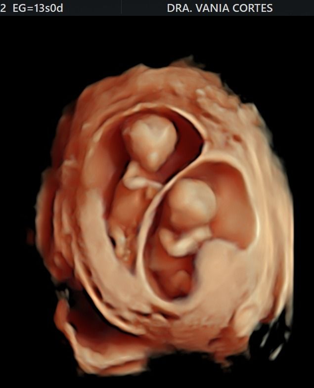 Vania Itzel Cortes Cernas-9