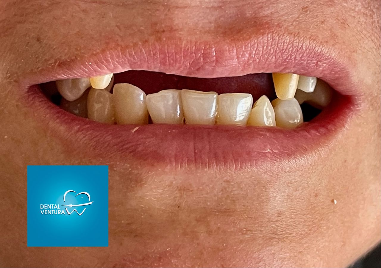 Antonio Cerda Ventura-3