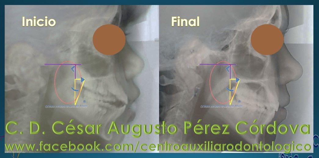 César Augusto Pérez Córdova-44