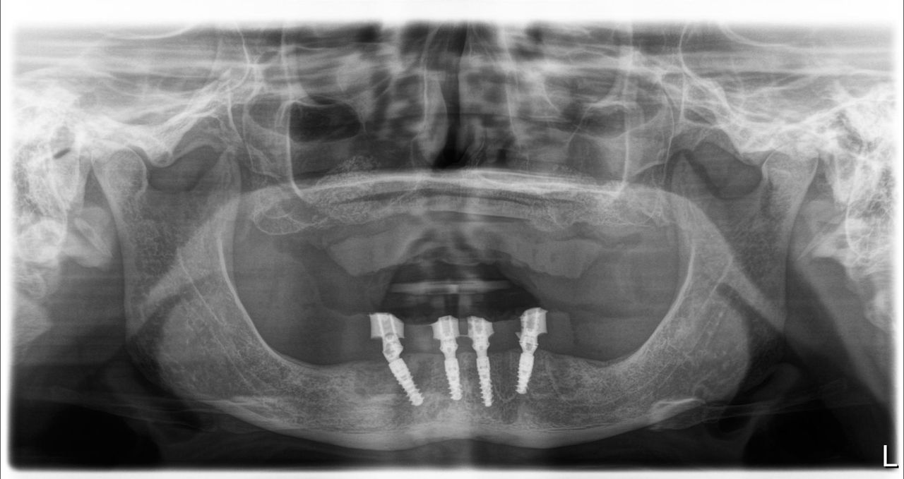 Josué Márquez Gómez-174