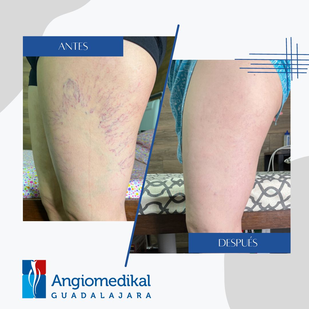 Carla Isabel Moreno Ramírez-16