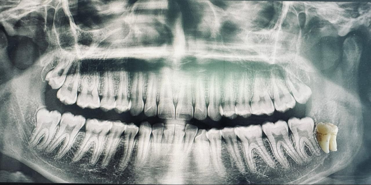 Jose Luis Castro Barron-0