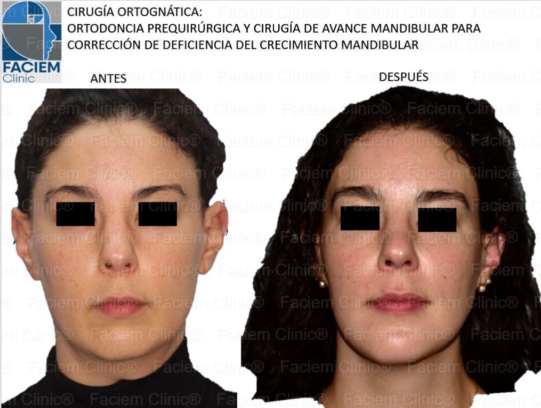 Arlen Colín Ordaz-7