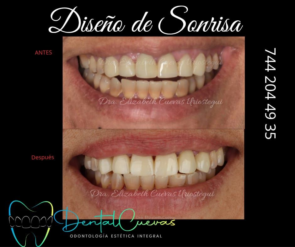 Elizabeth Cuevas Uriostegui-2