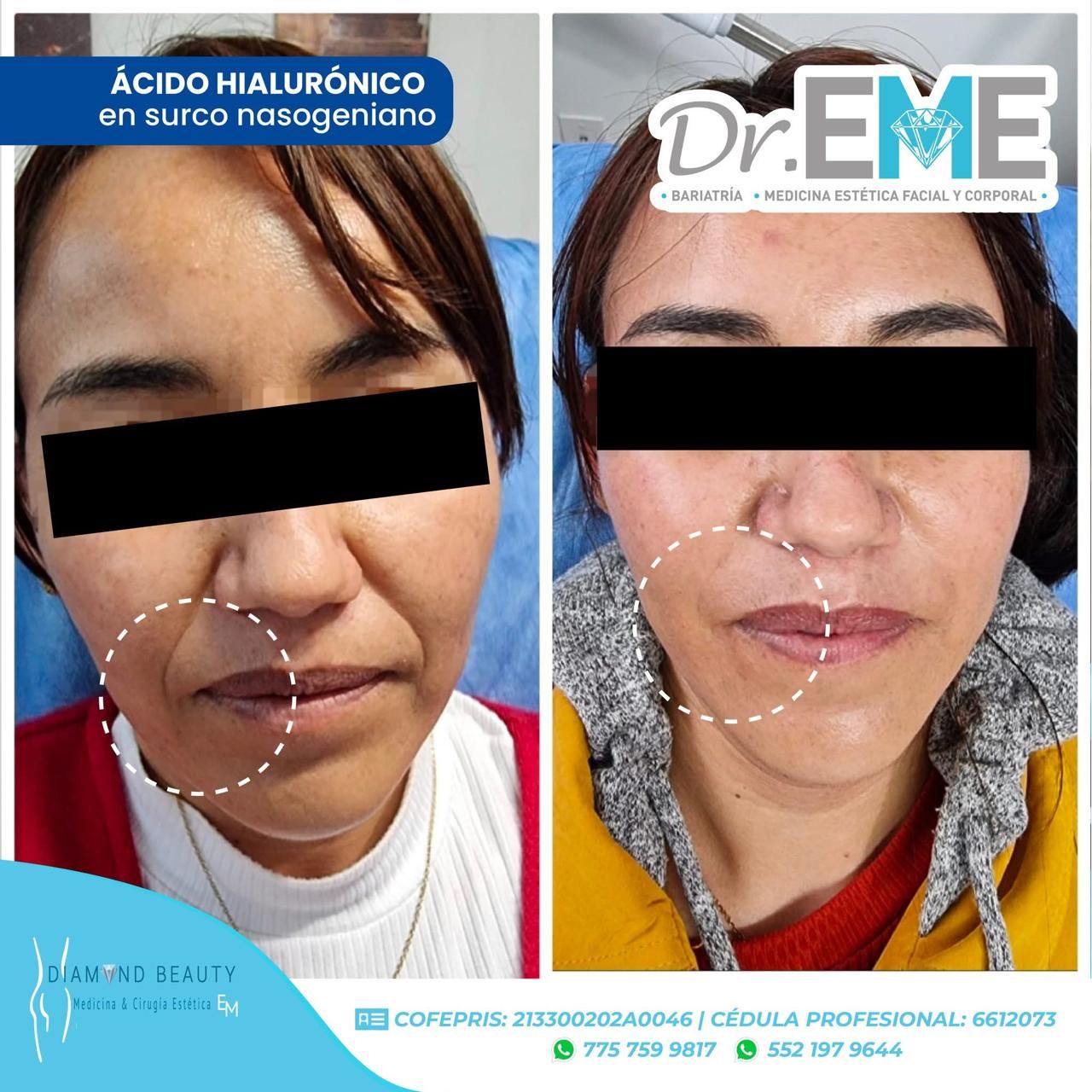 Emmanuel Mendoza Hernández-36