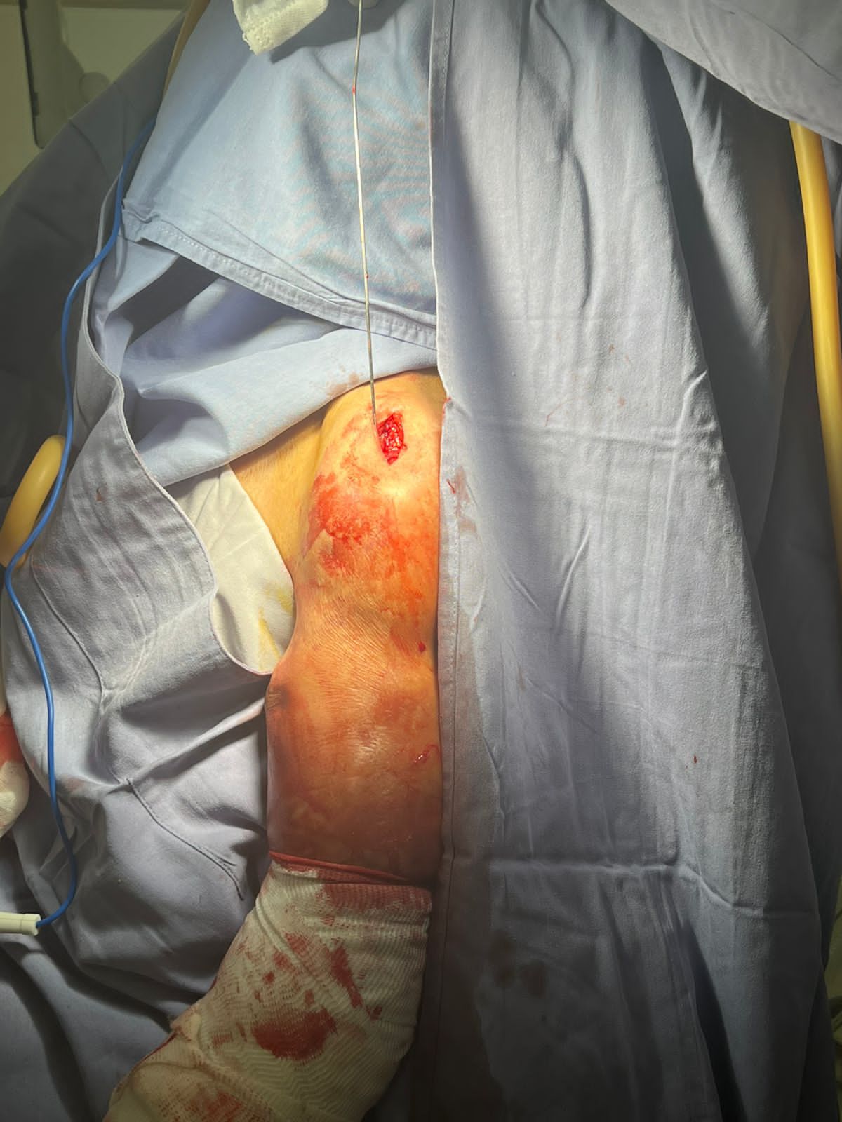 Oscar Alberto Pérez Peralta-25