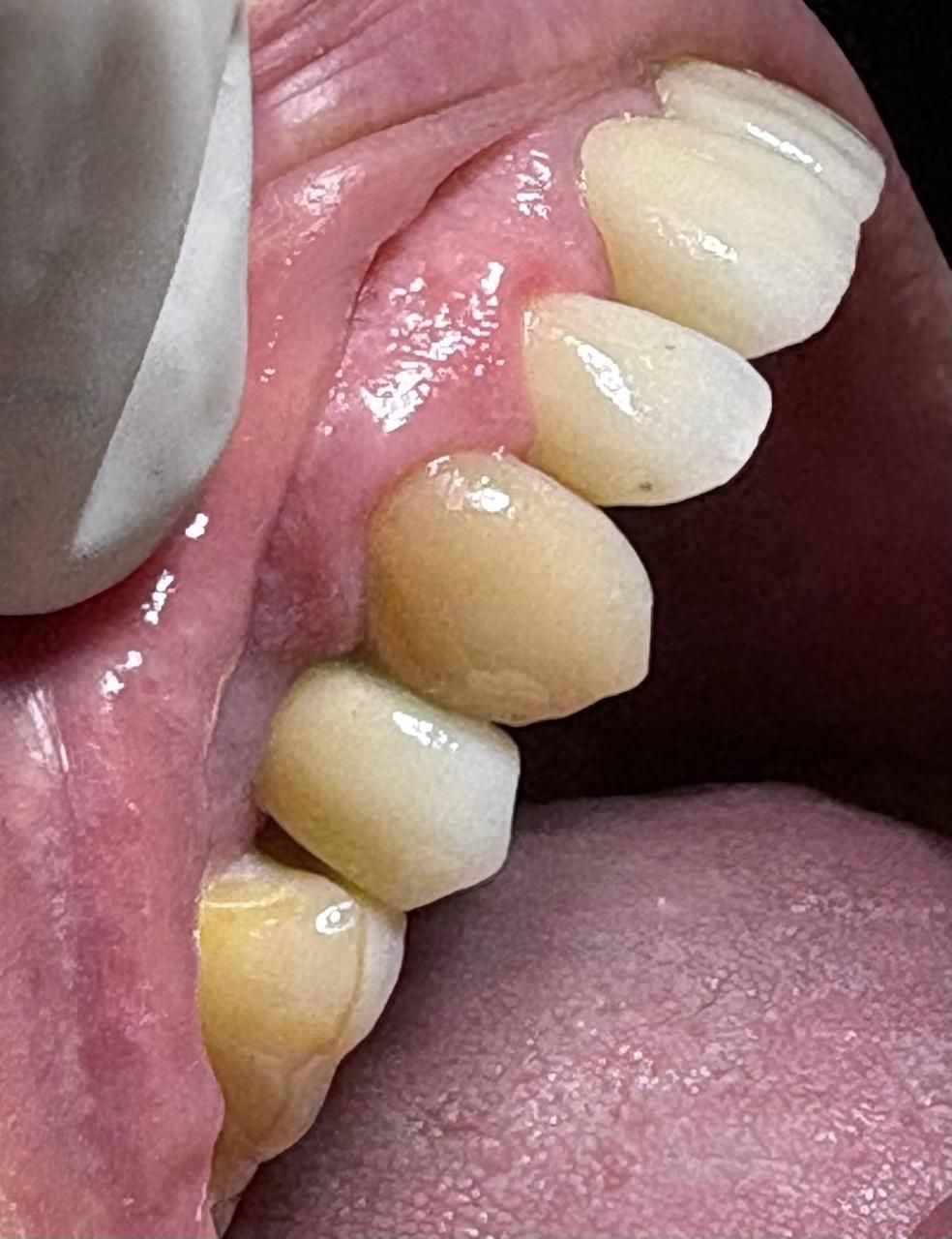 Arturo Romero Grande-33