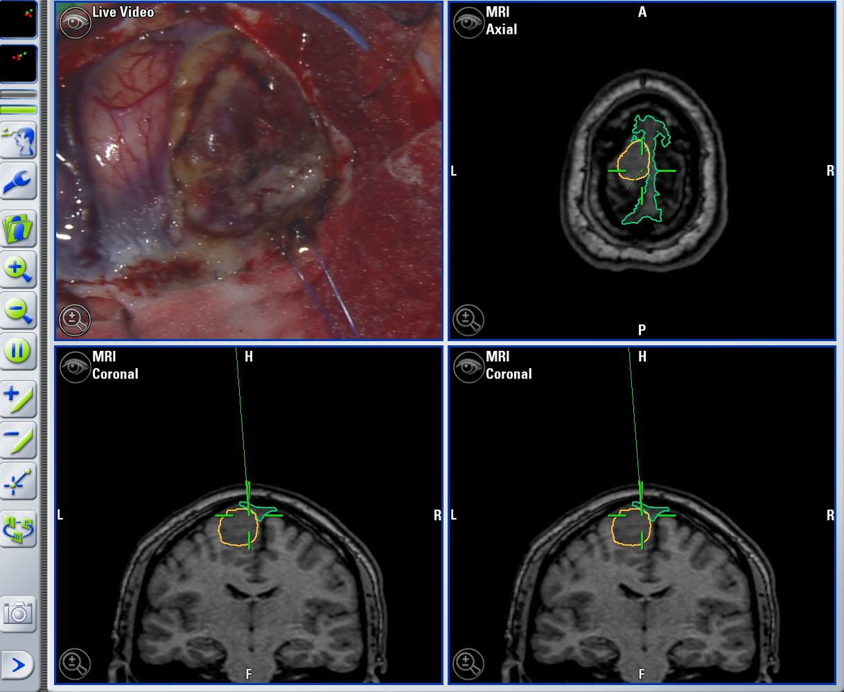 Enrique De Obieta Cruz-32