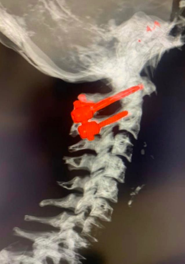 Griselda Collado Arce-10