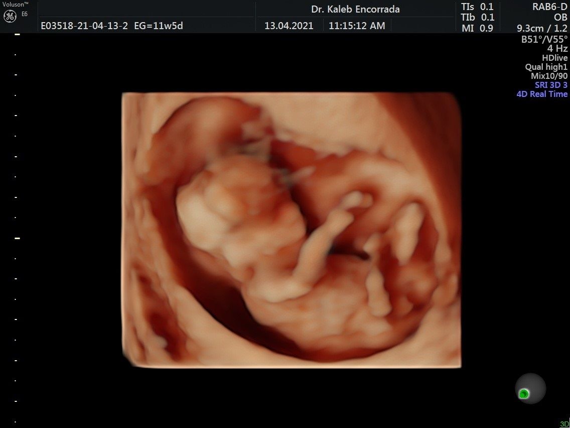 Hugo Kaleb Encorrada Luarca-17