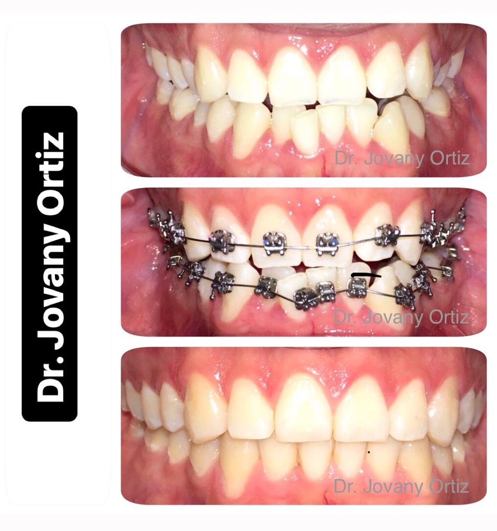 Gustavo Jovany Nava-27
