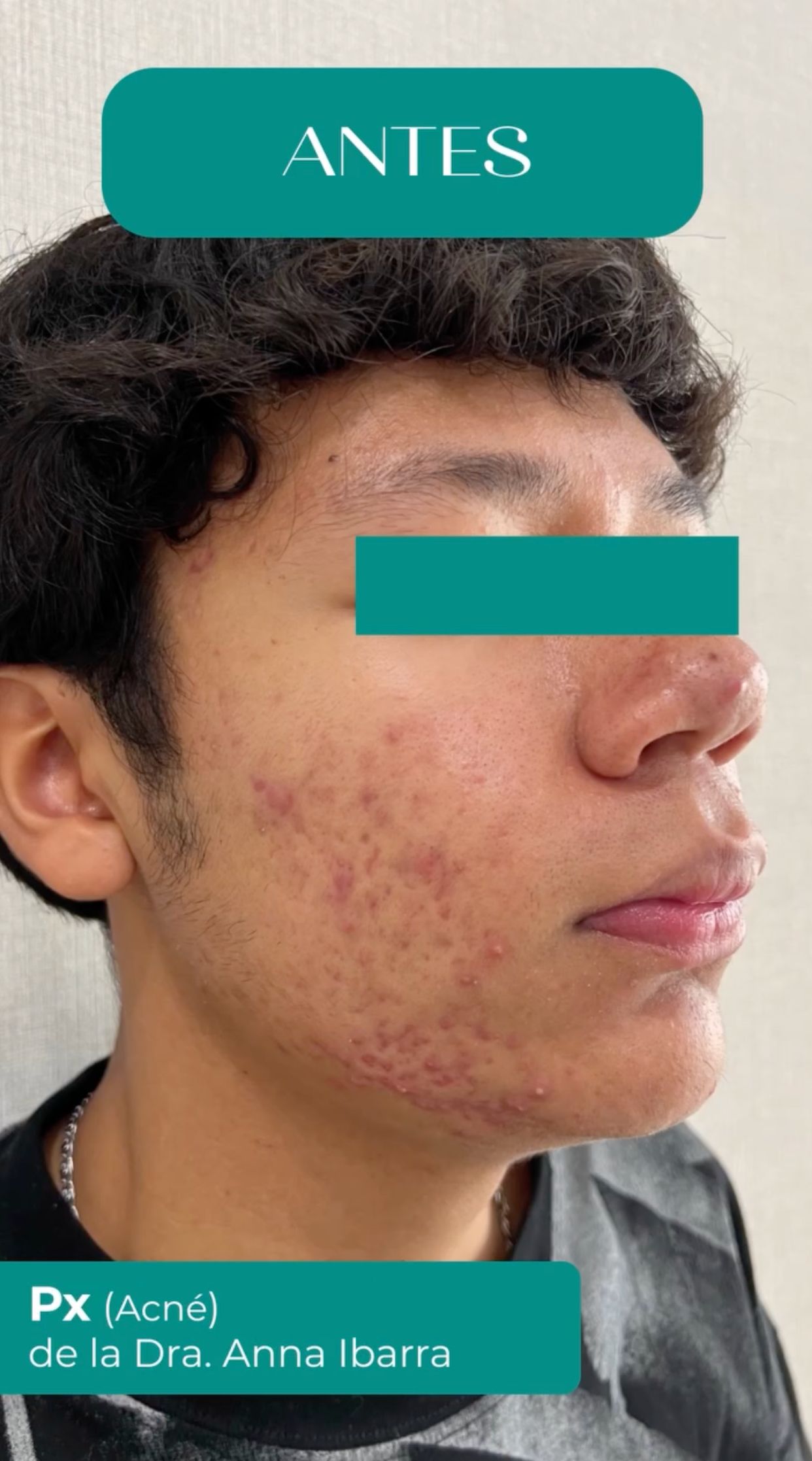 Anna Luisa Ibarra Puentes-13