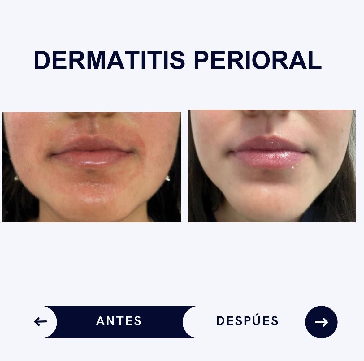 Itzel Anayn Flores Reyes-37