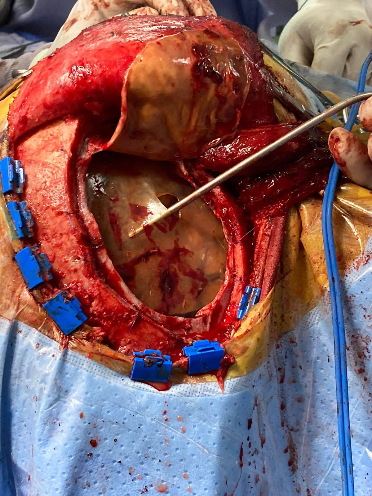 Gerson Reyes Rodríguez-67