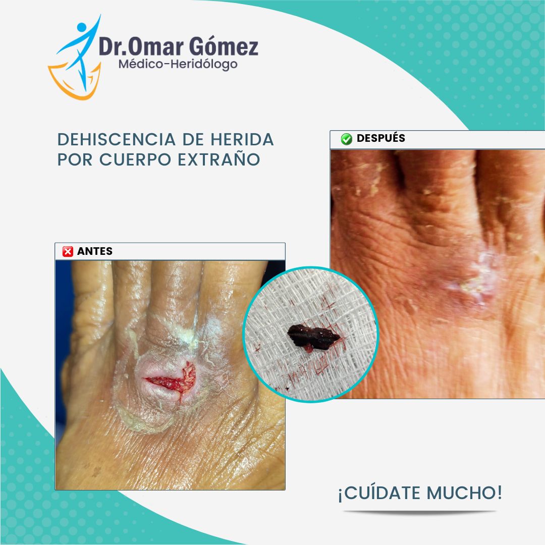 Omar Gómez López-3