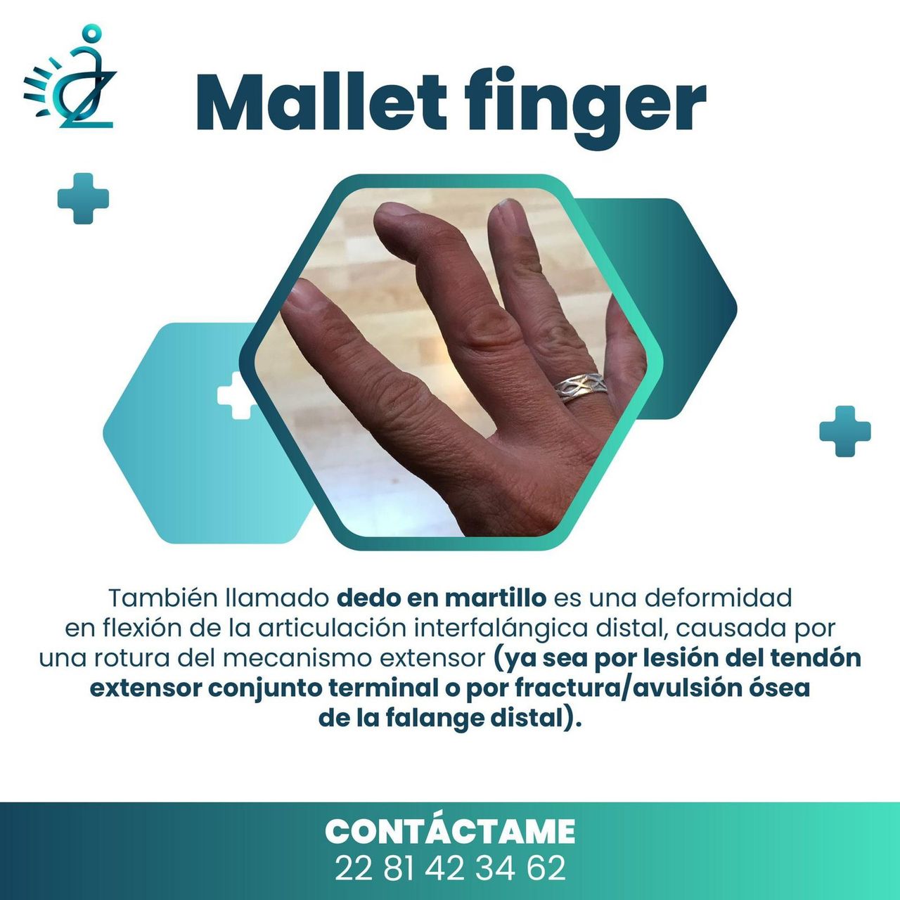 Aulio Cesar Ibarra Zavala-11