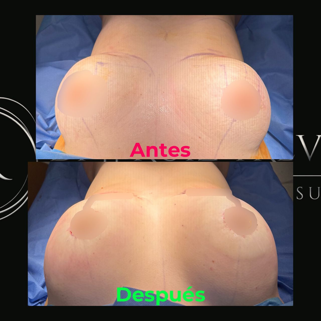 Juan José Ruiz Treviño-3