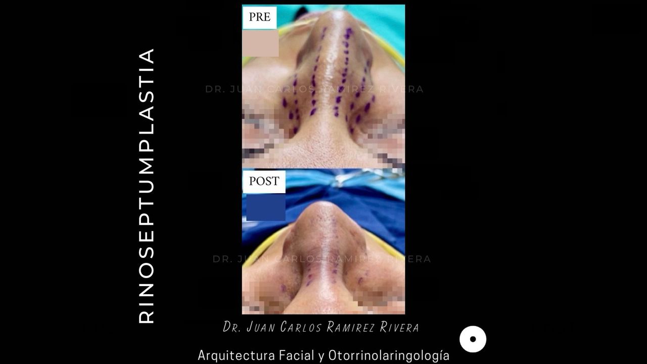 Juan Carlos Ramirez Rivera-3