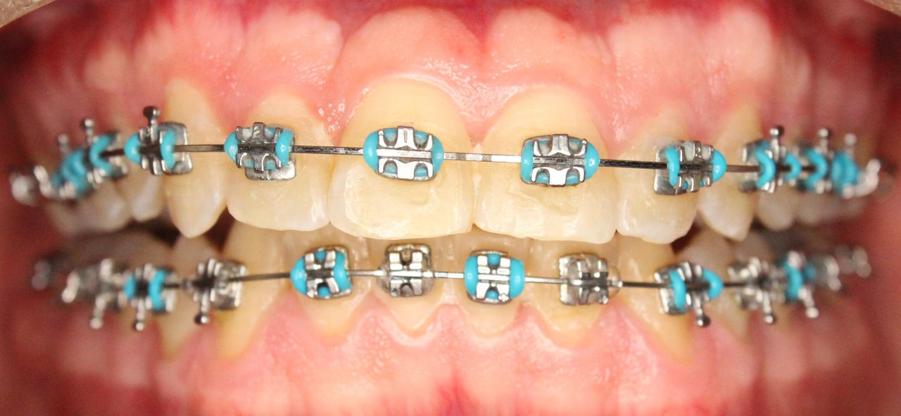 Emma Selenia Hernández Castillo-34