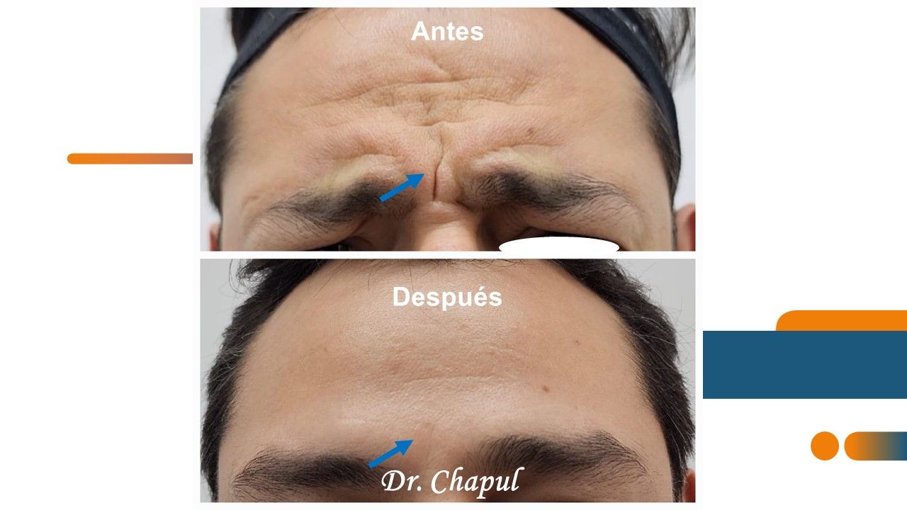 José Luis Muñoz Chapul-30