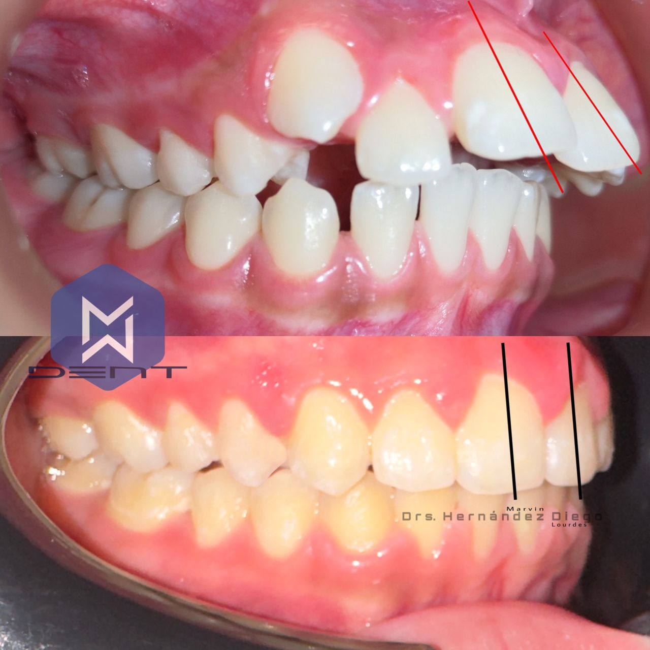 Marvin Adair Hernández Álvarez-38