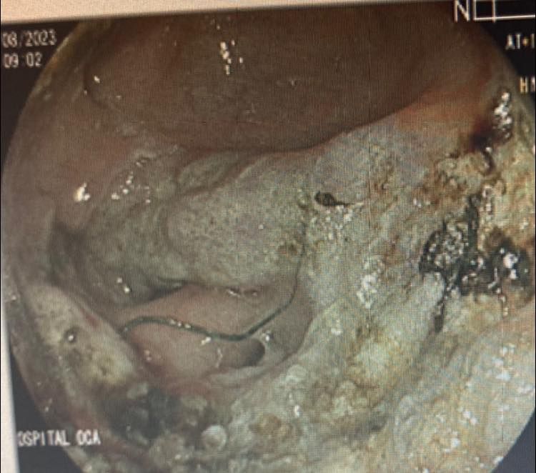 J. César Reyes Vásquez-28