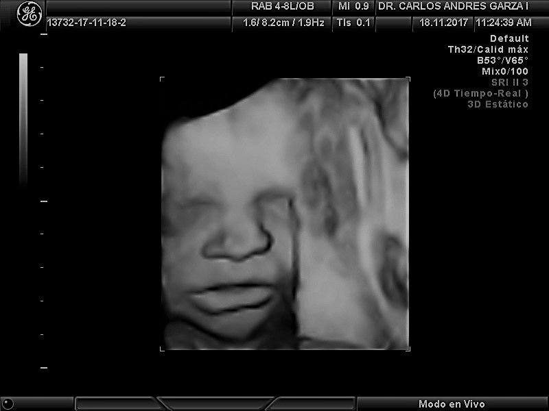 Carlos Andrés Garza Flores-3