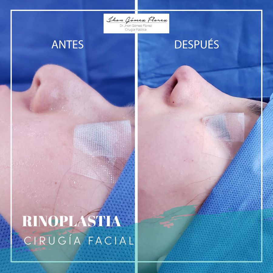 Jhon César Gómez Florez-68