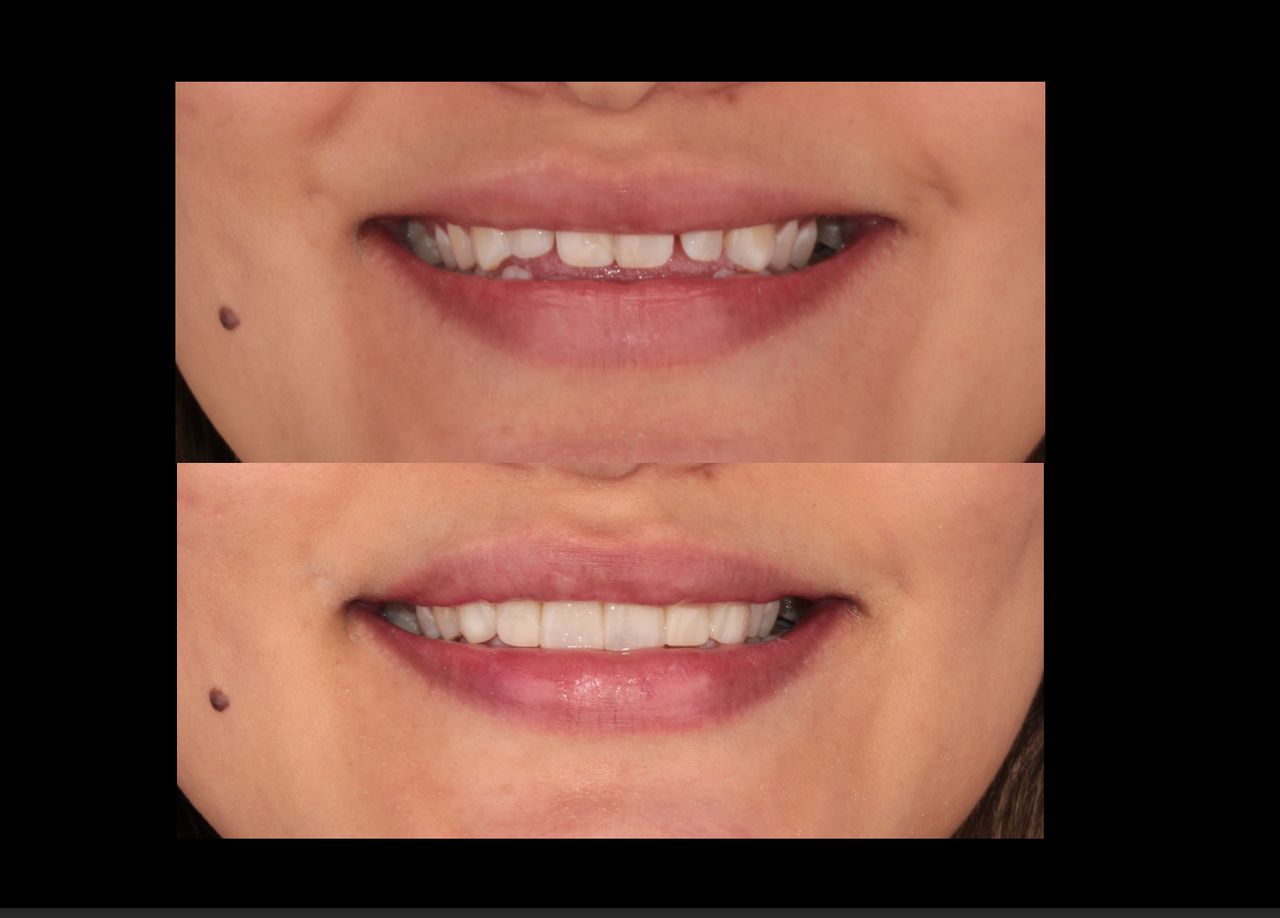 Aide Montserrat Orozco Gutierrez-20