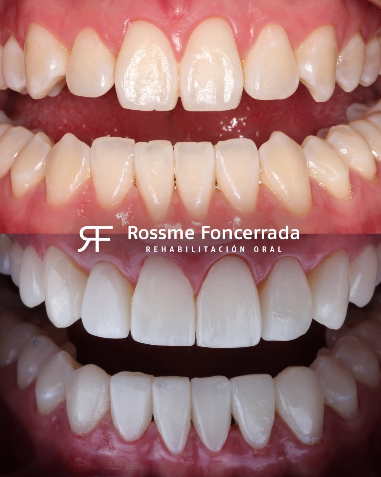 Rossme Foncerrada-17