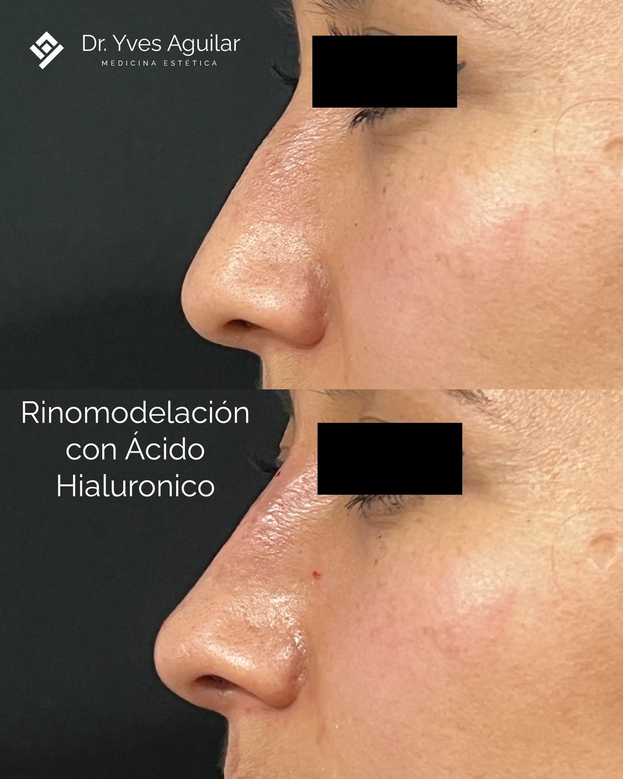 Yves Aguilar Fernández-8