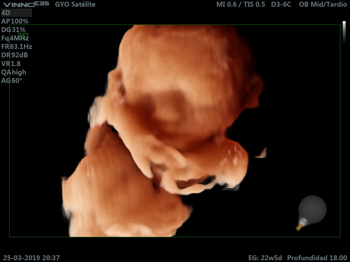 Giovanni Luis Tafelov Vindas-8