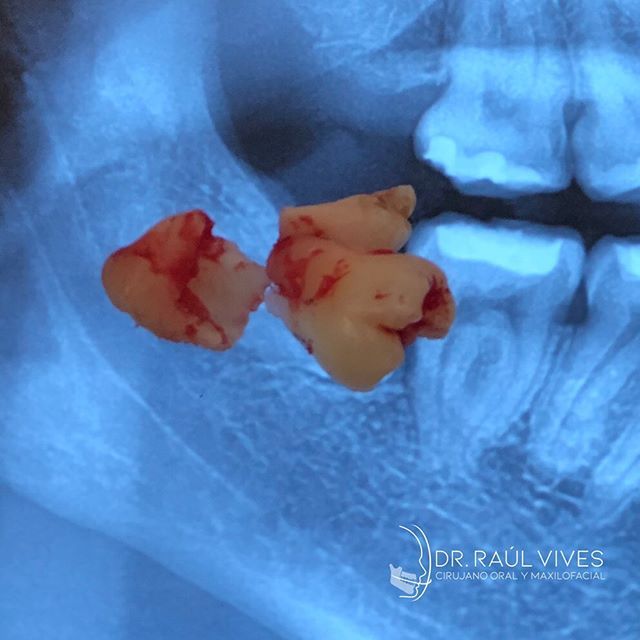 Raúl José Vives Serrano-9